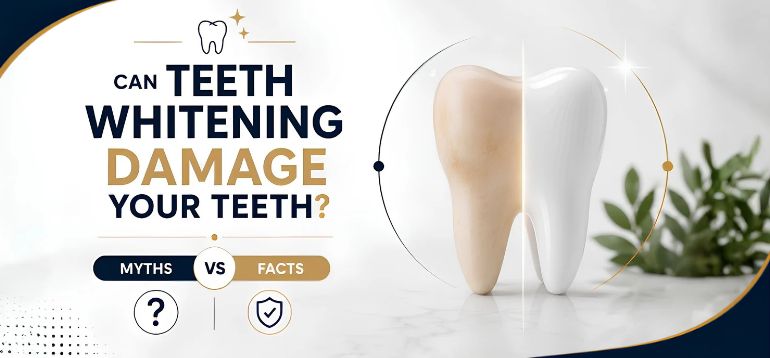 Can Teeth Whitening Damage Your Teeth? Myths vs Facts 