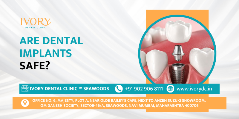 Are Dental Implants Safe ?