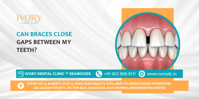 Can braces close gaps between my teeth?